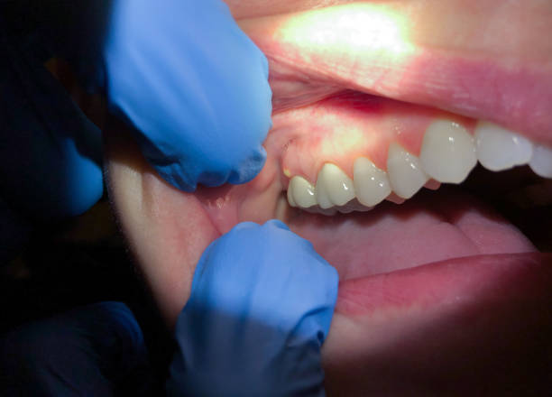 Best Emergency Treatment for Toothache in Cameron, WI