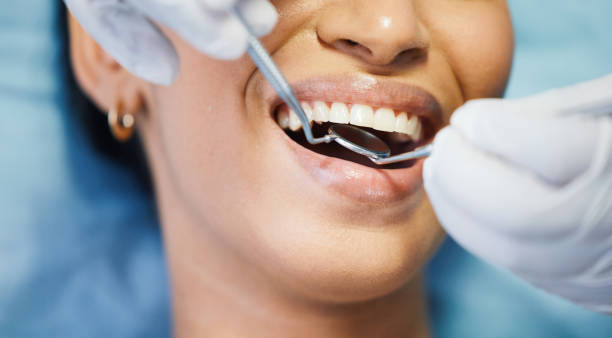 Best Emergency Root Canal Treatment in Cameron, WI